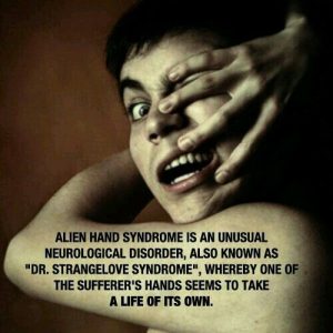 Alien Hand Syndrome)

